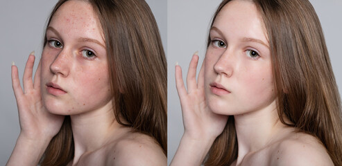 health, people, youth and beauty concept - Before and after cosmetic operation. Young pretty woman...