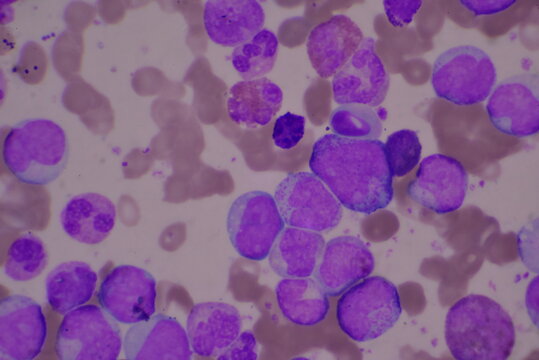 Immature and mature white blood cells.