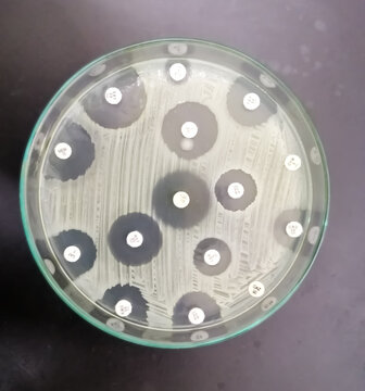 Antimicrobial Susceptibility Testing In Culture Plate. Susceptibility Of Staphylococcus Saprophyticus Bacteria, Drug Sensitivity Test, Disk Drug, Antibiotic Sensitivity.