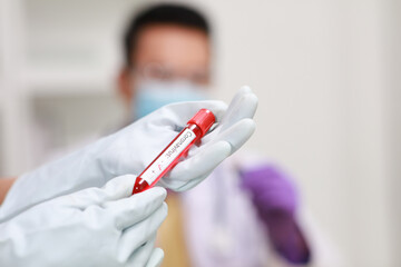 Nurse or Doctor hand with Medical gloves hold Sample blood from Patient 's corona virus (Covid-19)...