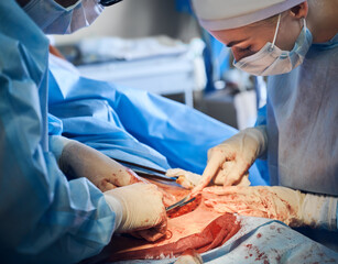 Plastic surgeon and assistant performing plastical surgical operation in operating room, removing excess fat from patient abdomen in hospital. Concept of abdominoplasty and cosmetic surgery.