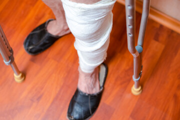 Medical Ideas. Disabled Man With Plaster And Bandage on His Leg Standing With Pair of Crutches Indoors.