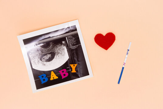 A positive pregnancy test strip, an ultrasound image of the fetus, a red heart and the inscription "baby". The concept of conception, waiting for the birth of a child, a family.