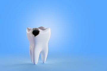 Tooth with hole blue background. Render 3d illustration