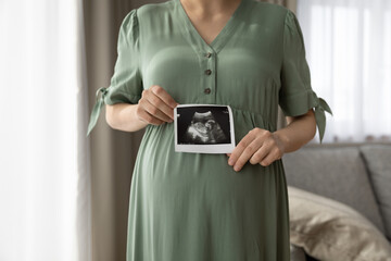 Close up cropped of pregnant woman in green dress showing ultrasound picture at camera, standing at home, young future mom demonstrating scan, waiting for first baby, pregnancy and motherhood concept
