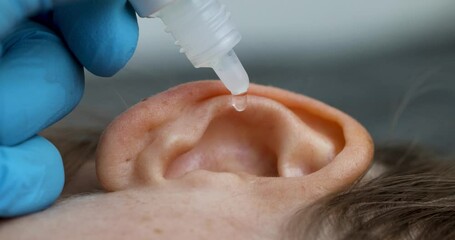 doctor dripping ear drops into patient ear. ear pain treatment and clogged ears concept