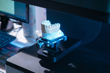 Dental 3D scanner. Close-up of a dental scan with prosthesis. It is designed to create...
