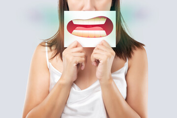 Asian woman in the white wear holding a white paper with the yellow teeth cartoon picture of his...