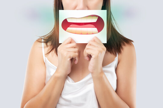 Asian woman in the white wear holding a white paper with the yellow teeth cartoon picture of his mouth against the gray background, Bad breath or Halitosis, The concept with healthcare gums and teeth