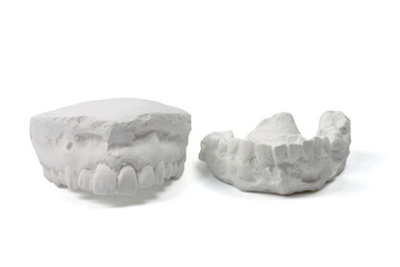 Cast gypsum model plaster for dental molar teeth before braces in laboratory isolated on white background included clipping path.