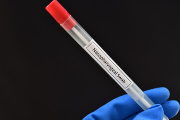 Nasopharyngeal swab from patient for COVID-19 test by using RT-PCR method 