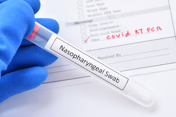 Nasopharyngeal swab from patient for COVID-19 test by using RT-PCR method 