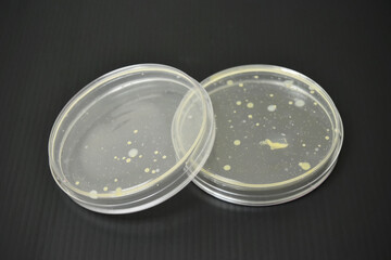 Colonies of bacteria in petri dish.