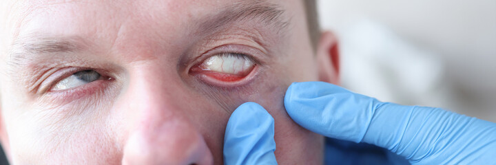 An ophthalmologist examines the patient's eye closeup