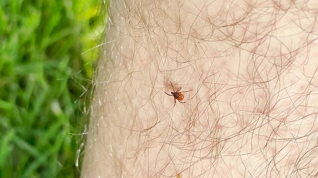 tick crawls on human skin