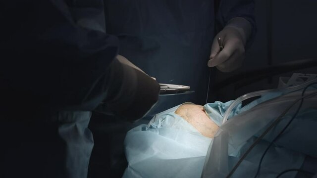 Modern surgical operating room. Surgeons team performing operation in surgery room.  
Close-up Shot in the Operating Room. brain surgery