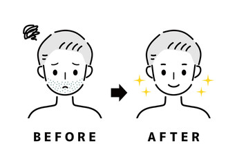 Naklejka premium 男性 ひげ ビフォー アフター