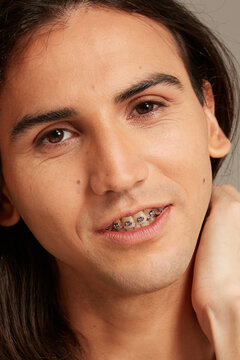 braces closeup