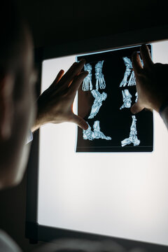 Doctor looking on X-Ray