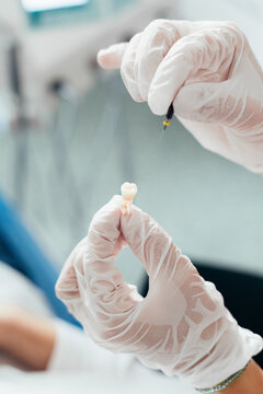 A Dentist Holding an Artificial Tooth 