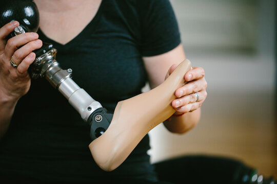 Person Holding Prosthesis