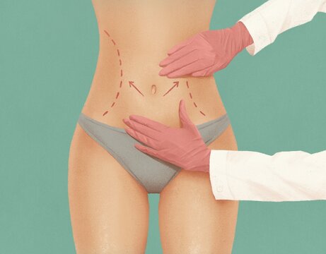 A surgeon examining a woman's body before plastic surgery