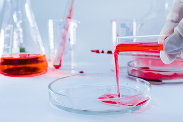 Medical laboratory. A hand in a medical glove pours blood into a Petri dish for analysis. Laboratory tests.