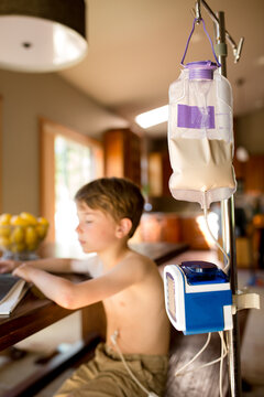 Formula and feeding pump on an IV stand hooked to a young boy
