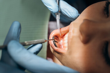 Close up view, the dentist examines the patient's lower jaw. The dentist uses dental instruments