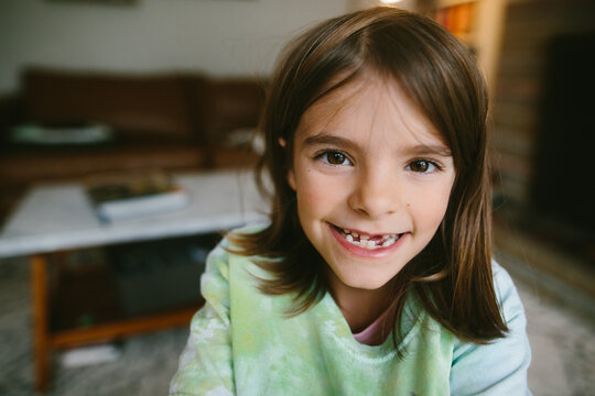 closeup of little kid with missing tooth