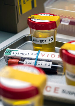 Various analyses of urine, saliva and blood of homicide suspects in crime lab, conceptual image.