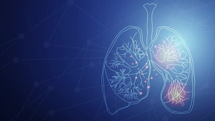 Human lung. lung damage from the corona virus Covid 19. The technology concept, Animation of human lungs. - Powered by Adobe