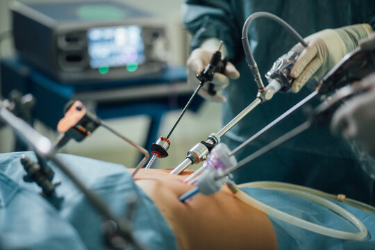 Laparascopic surgery