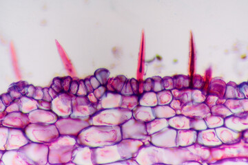gallnut plant cells micrograph