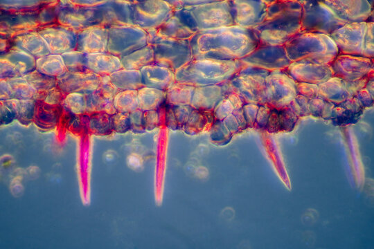 gallnut plant cells micrograph