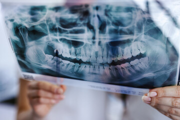 Computed tomography of teeth 