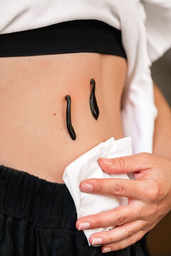 Medicinal leech 