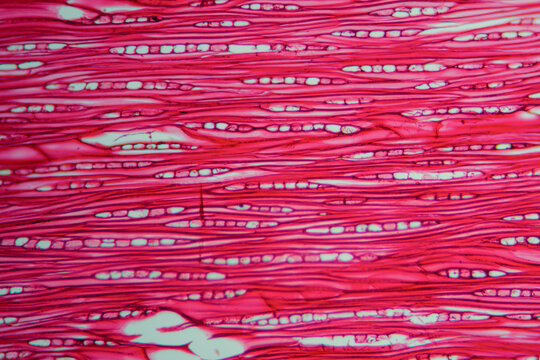 Agarwood plant cells micrograph
