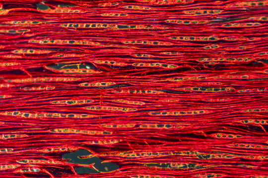 Agarwood plant cells micrograph