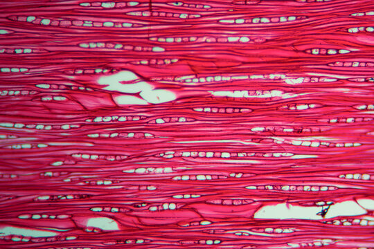 Agarwood plant cells micrograph