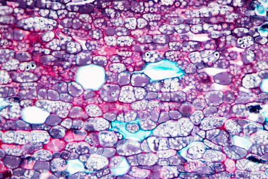 Cinnamon bark plant cells micrograph