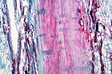 Plant vascular tissue under the light microscope view.