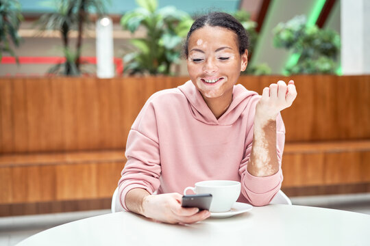 Black African American Woman With Vitiligo Pigmentation Skin Problem Indoor Dressed Pink Hoodie