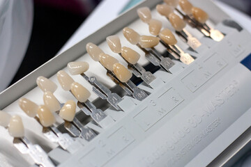 Dental veneers, thin and small foils that are used as a cover for your teeth, giving it a natural and aesthetic look