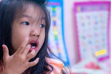 A 5-year-old Asian girl broke her first tooth.