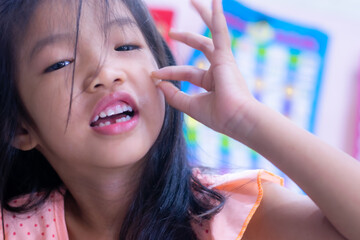 A 5-year-old Asian girl broke her first tooth.