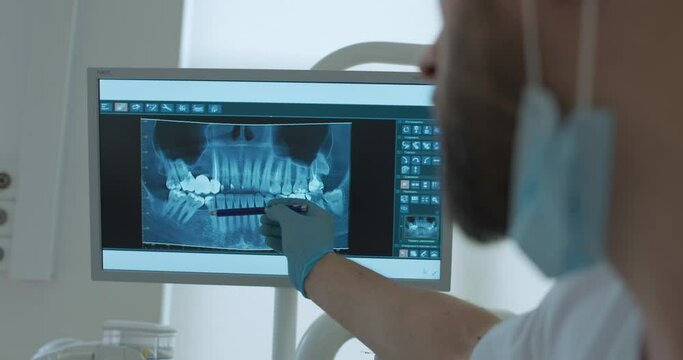 A male dentist is using a pen for showing teeth on a monitor screen with a picture of a computed tomography scan of human teeth.