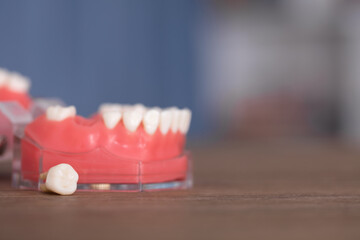 Mouth model and extracted tooth model