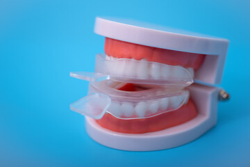 individual tooth tray for whitening and mold. imitation of a denture