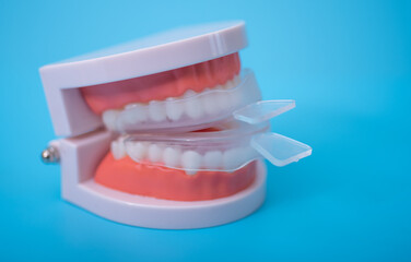 individual tooth tray for whitening and mold. imitation of a denture